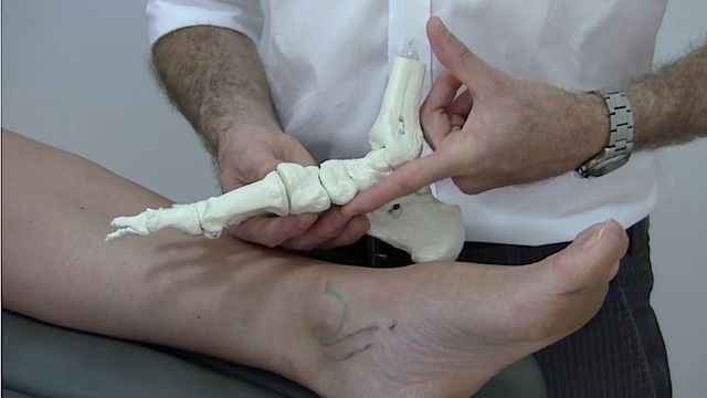 Tibialis Posterior Tendinopathy
